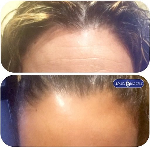 liquid biocell collagen 6 2